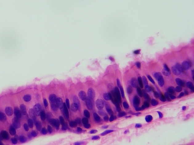 Pseudostratified Epithelium Slides - Pseudostratified Epithelium 22 400X
